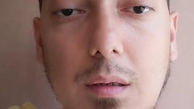 пересадка волос спустя 4 месяца.