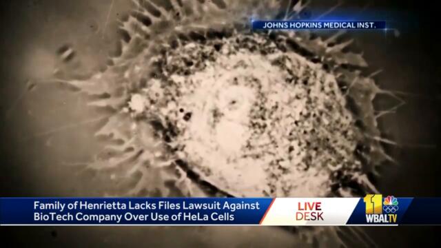 Henrietta Lacks' estate sues Thermo Fisher Scientific