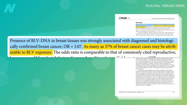 Breast Cancer and the Bovine Leukemia Virus in Meat and Dairy