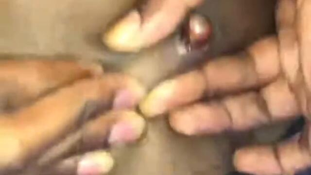 BOLO3K takes a bullet out his back 2 years after being shot!!!