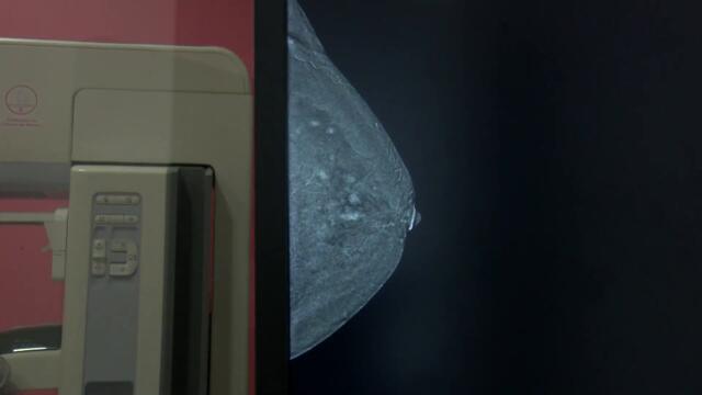 ¡Únete al Trenzatón 2022 y dona tu cabello a víctimas de cáncer de mama!