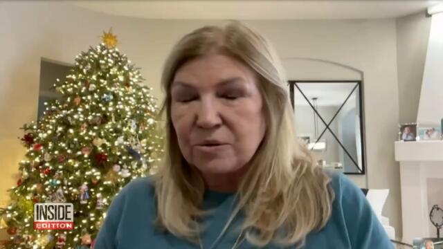 Armed Robber Steals Car Keys From Woman Walking Her Dog