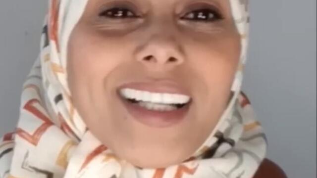 الضحك وتقشاب