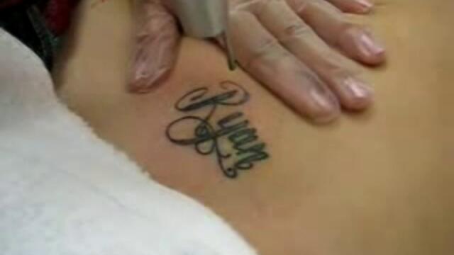 Махане На Татуировка С Лазер - Vbox7[via torchbrowser.com]