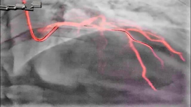 Γιώργος Μαζωνάκης - μαΖΩ Ακόμα - все още Мазо