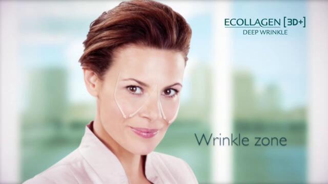 Oriflame Ecollagen 3d Deep Wrinklevia torchbrowser.com - Vbox7[via torchbrowser.com]