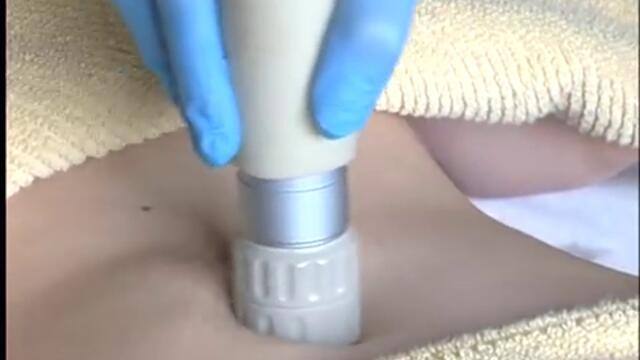 Acoustic Waves терапия Derma Vita-360p