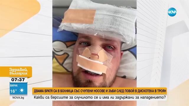 Двама братя са със счупени носове и зъби след побой в дискотека - Здравей, България (24.09.2024)