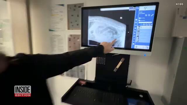 24 Socks Among Weird Things a Vet Found in Dog's Stomach