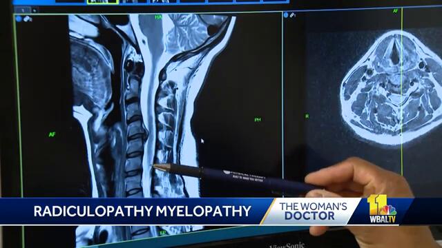 These are the painful symptoms of radiculopathy, myelopathy