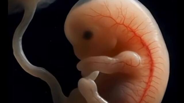 Embriologia da 7a semanas à 12a semanas gestacional #fonoaudiologia #neuroexplica